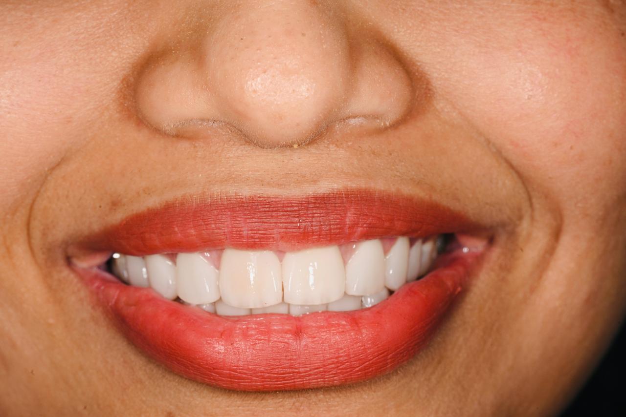 Case 01 after dental treatment