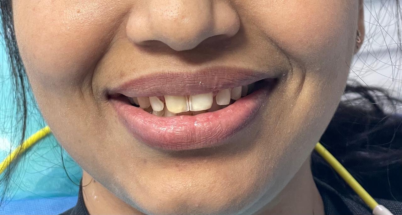 Case 01 before dental treatment