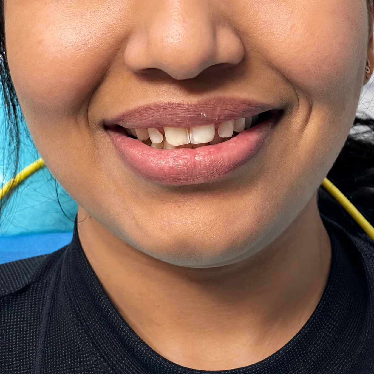Case 01 before dental treatment
