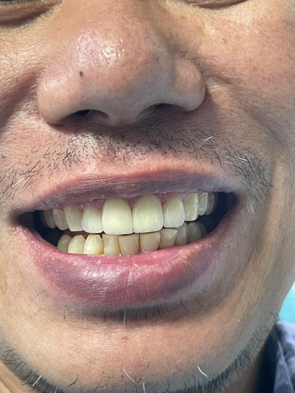 Case 02 after dental treatment