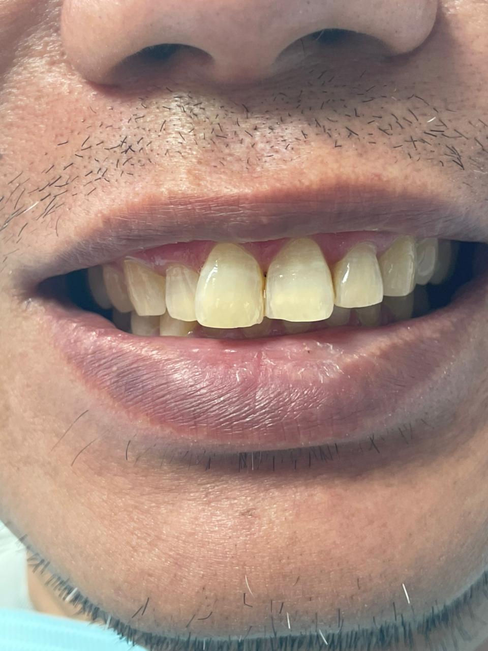 Case 02 before dental treatment