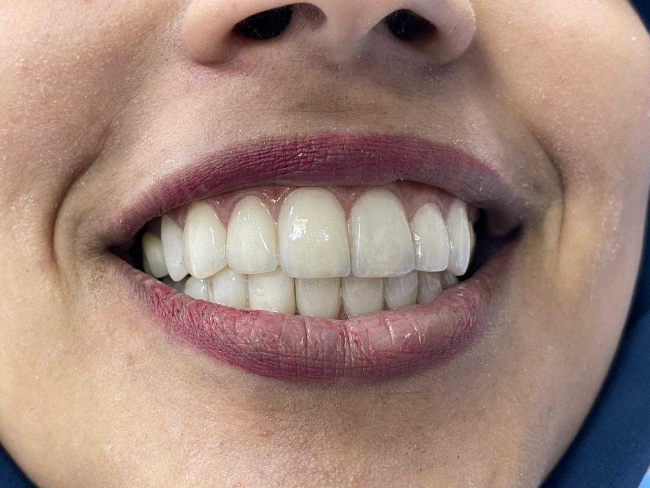 Case 03 after dental treatment