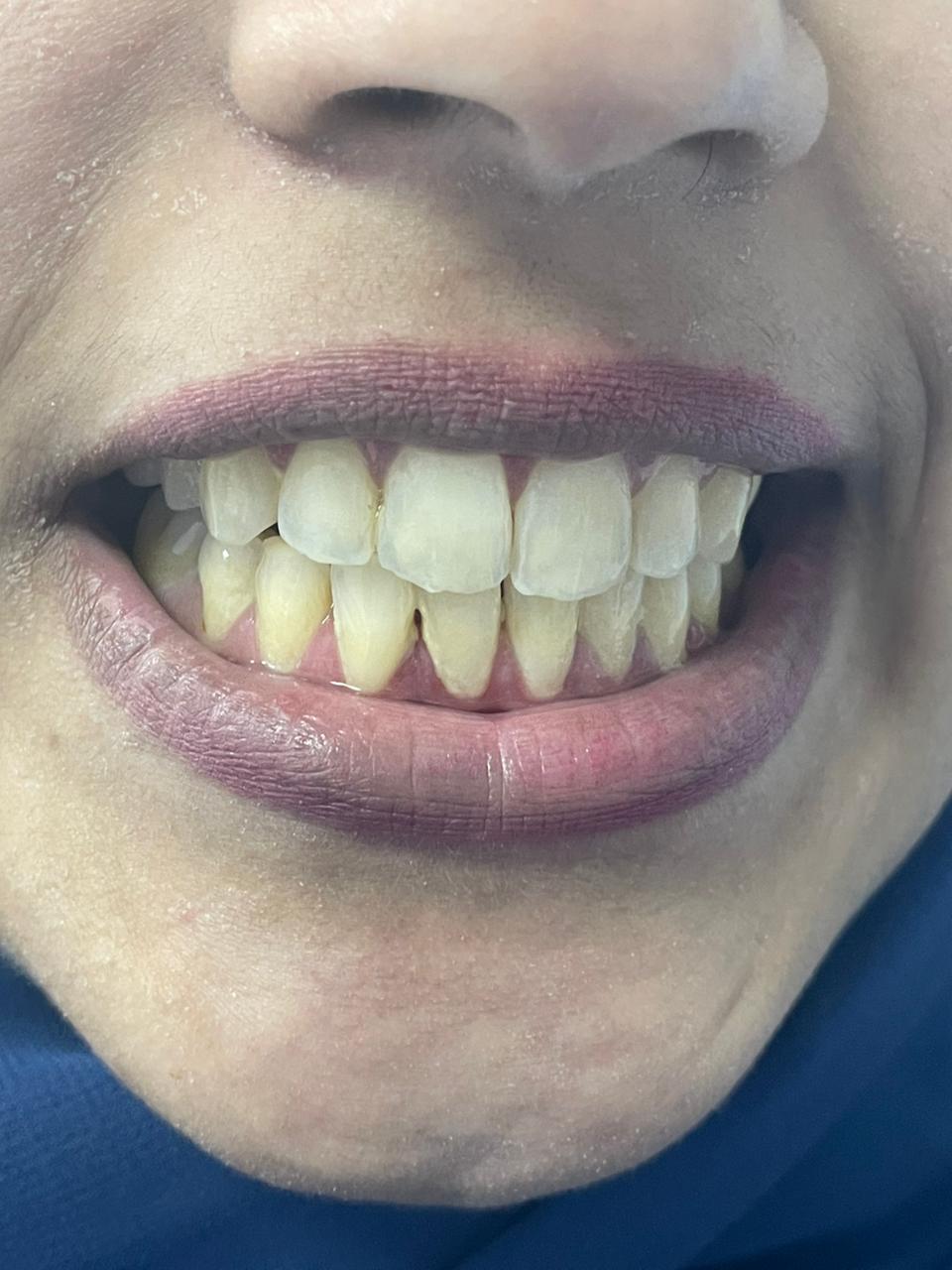 Case 03 before dental treatment