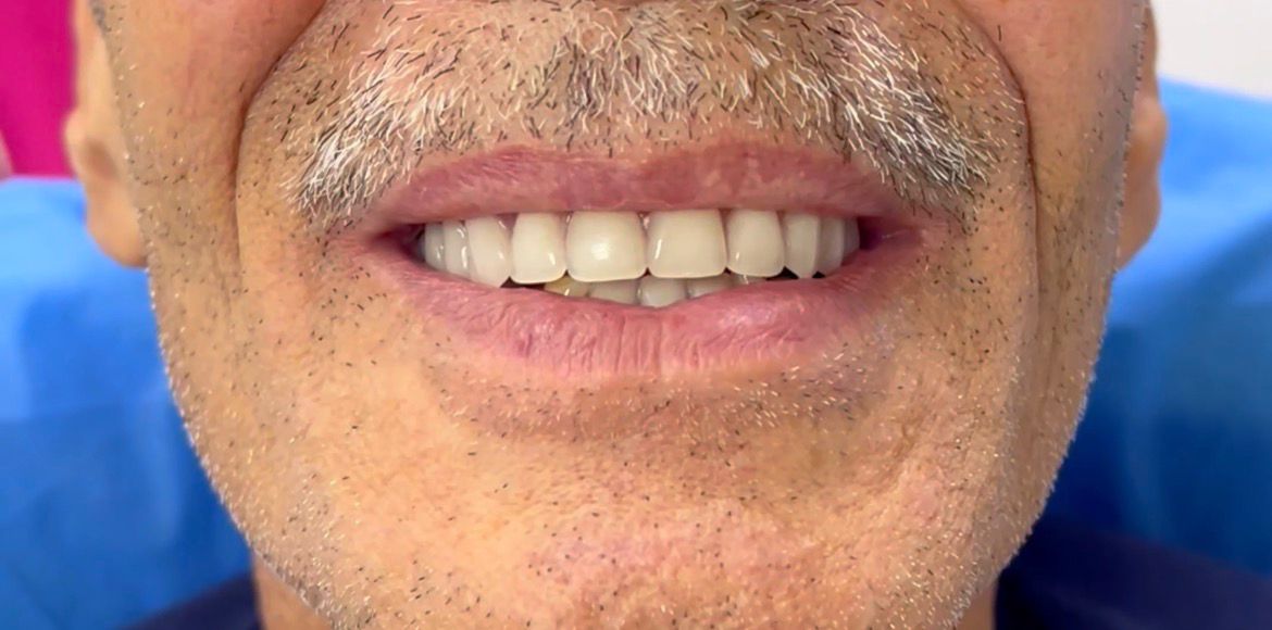 Case 04 after dental treatment