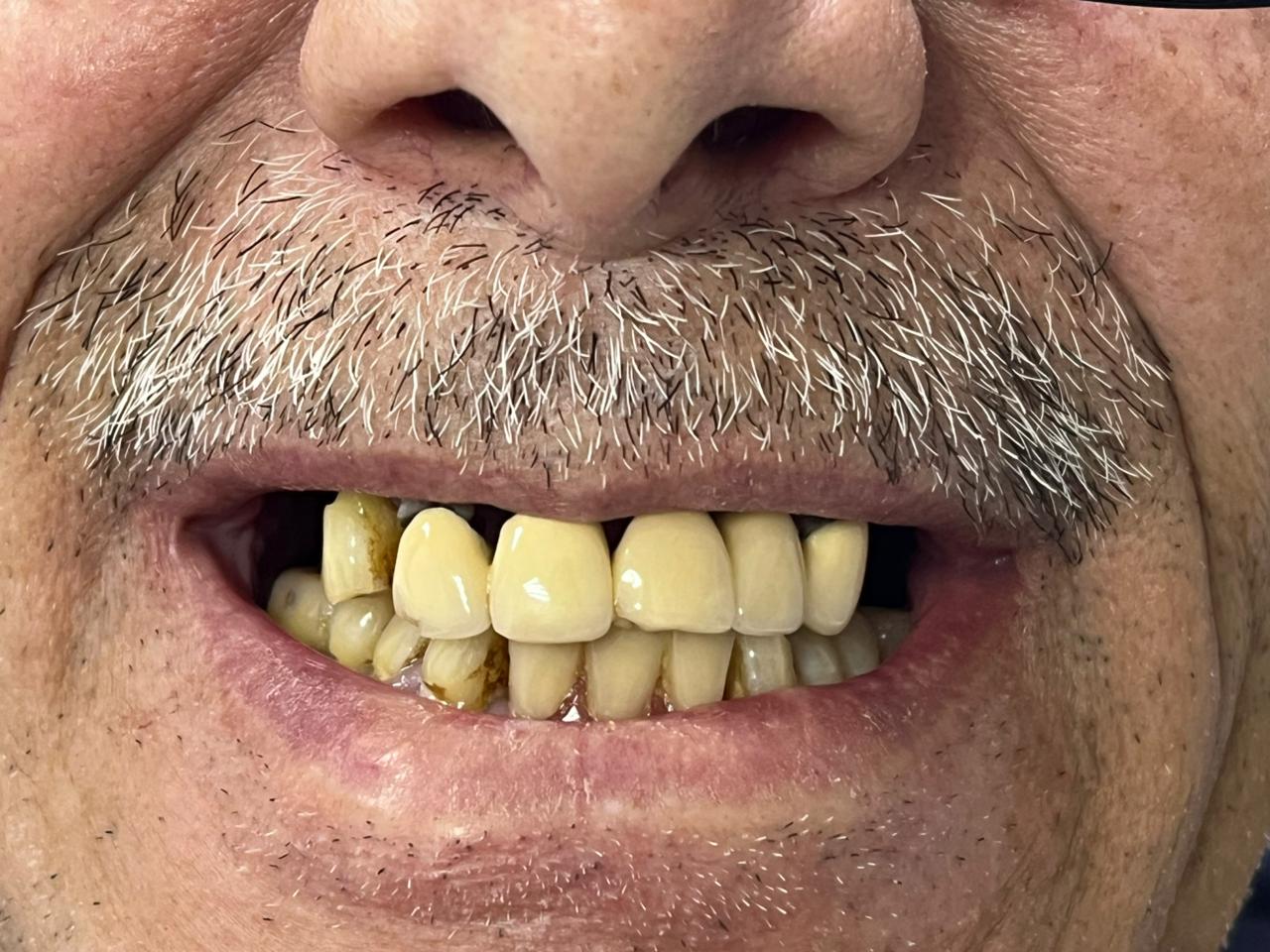 Case 04 before dental treatment