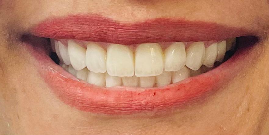 Case 05 after dental treatment