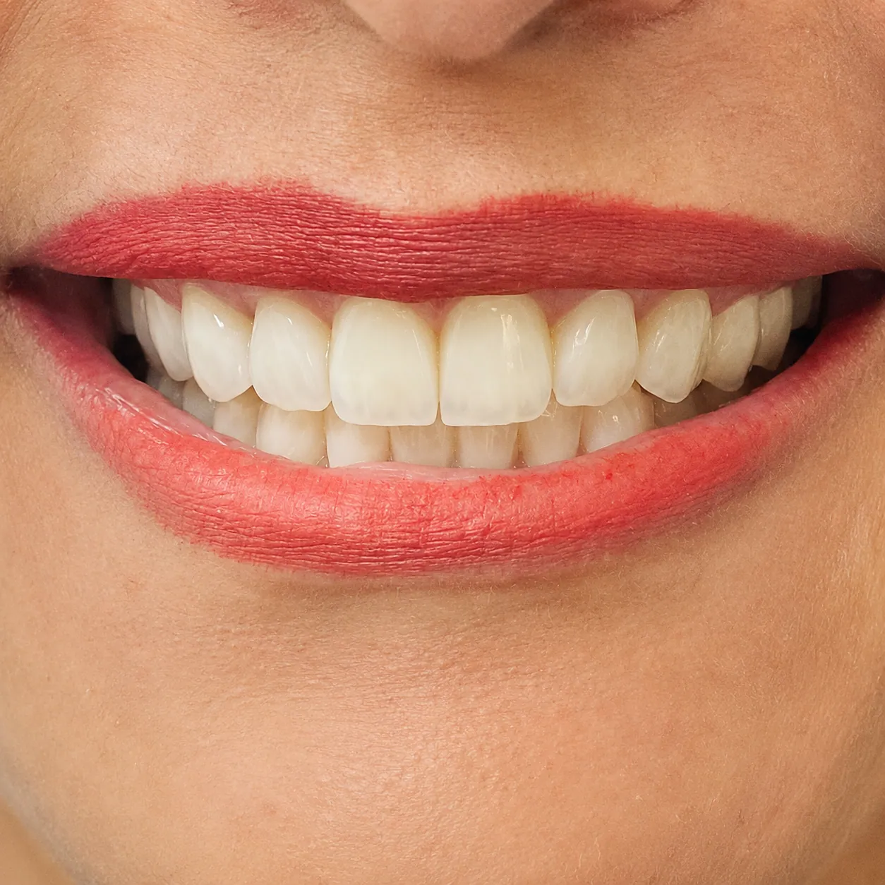 Case 04 after dental treatment