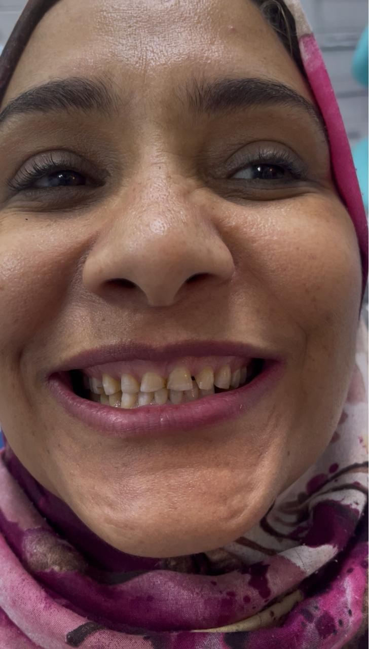 Case 06 before dental treatment