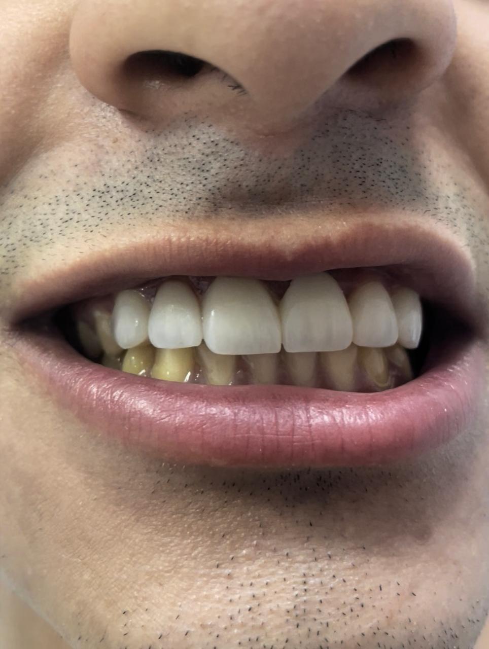 Case 07 after dental treatment