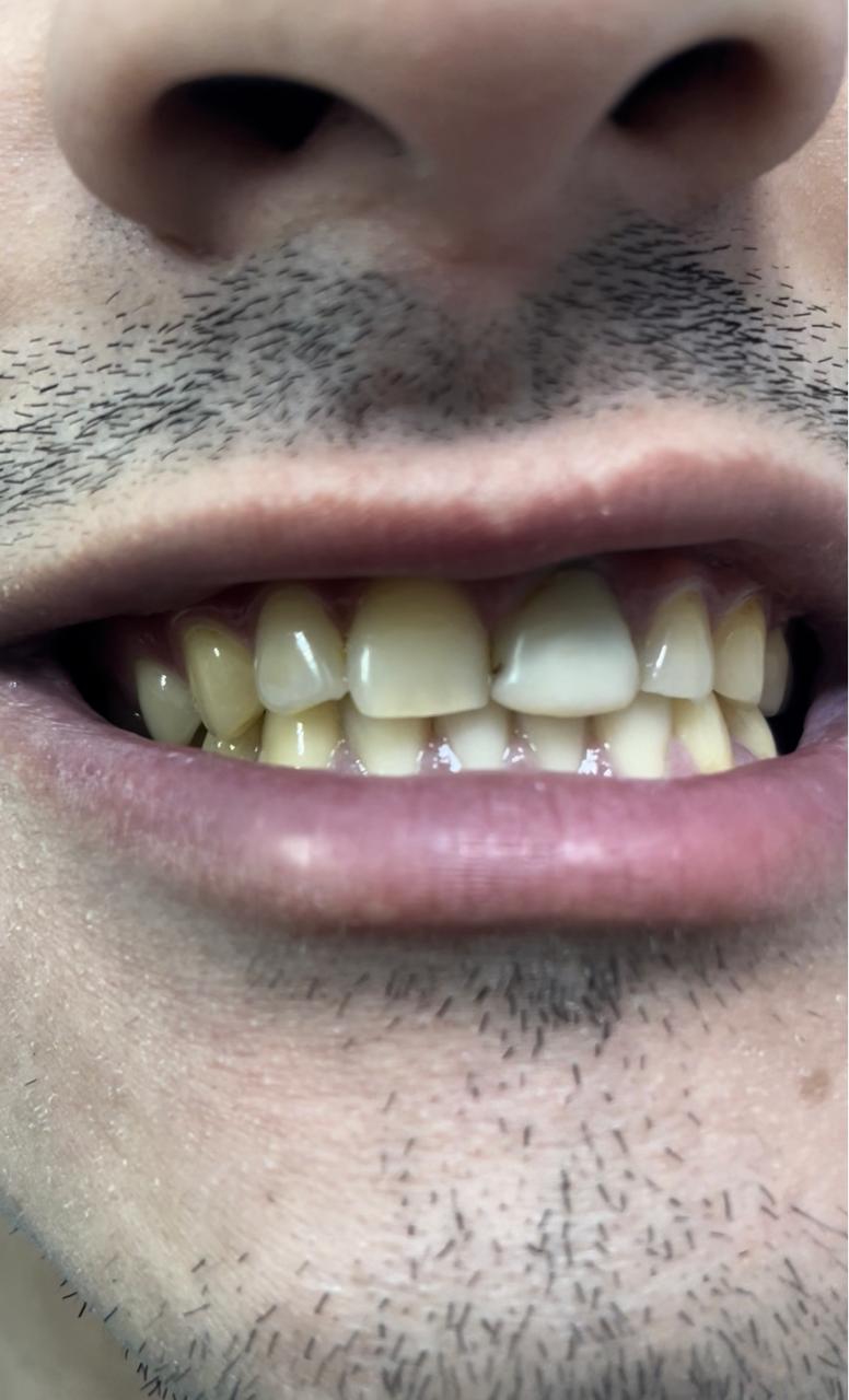 Case 07 before dental treatment