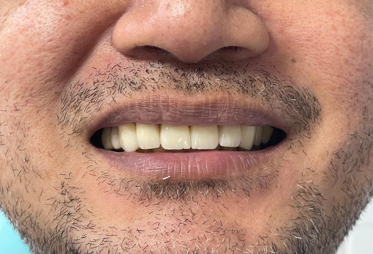 Case 08 after dental treatment
