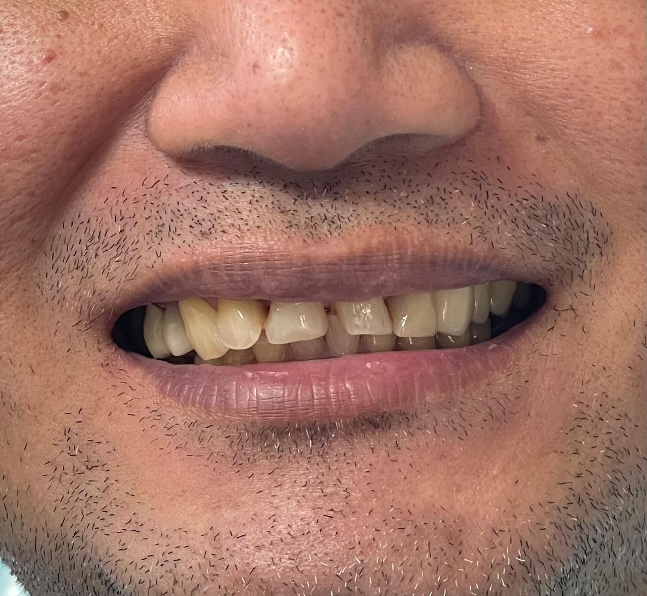 Case 08 before dental treatment