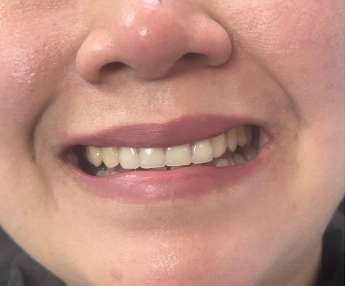 Case 09 after dental treatment