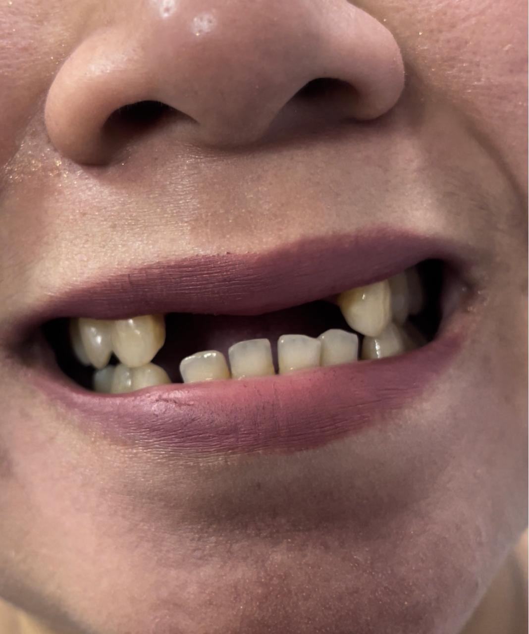 Case 09 before dental treatment
