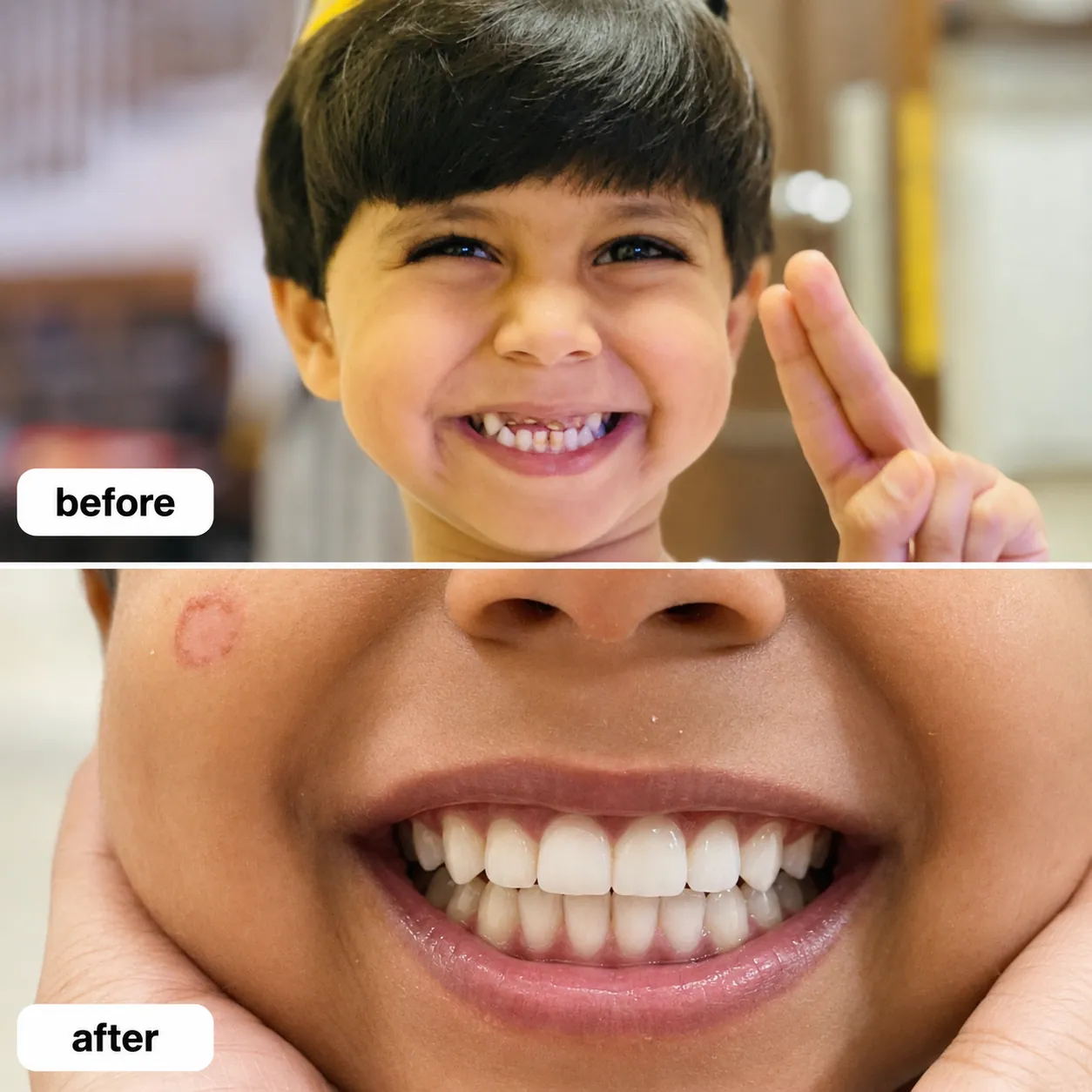 Case 09 before and after dental treatment
