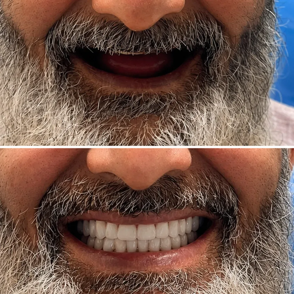 Case 06 before and after dental treatment