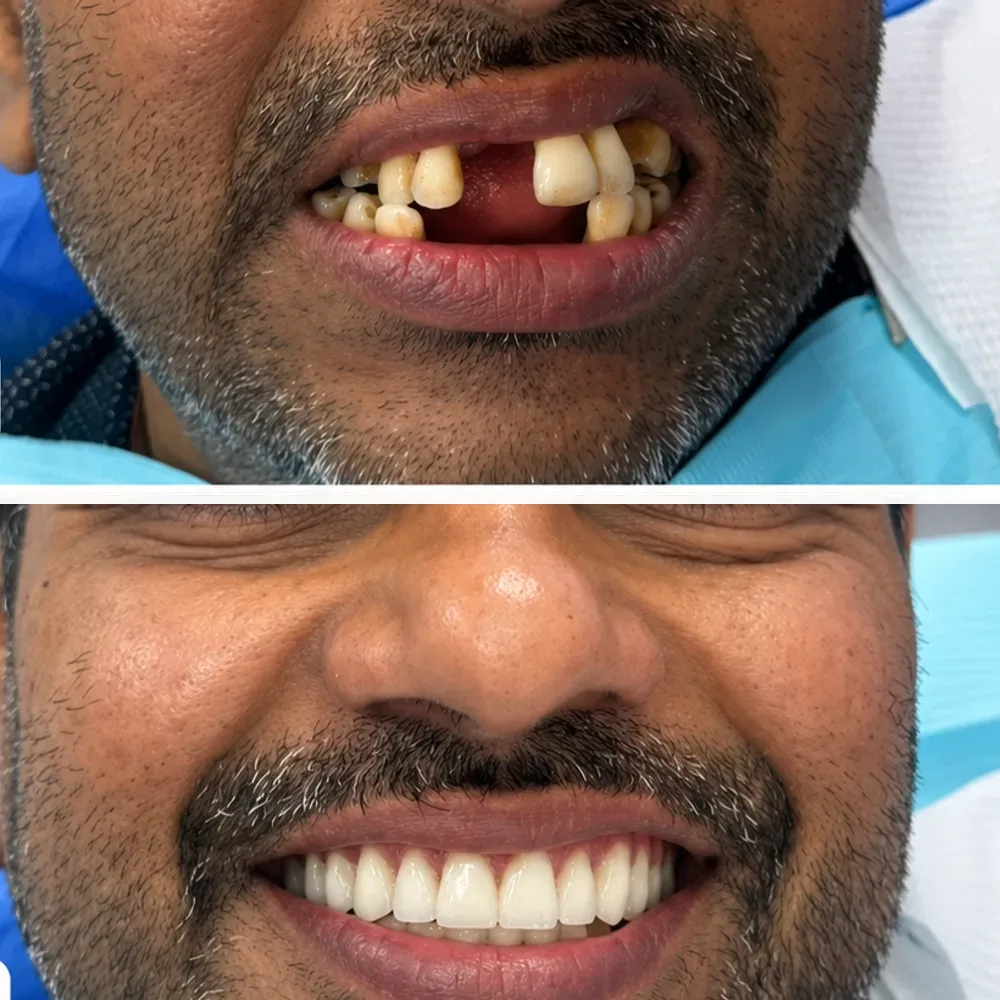 Case 07 before and after dental treatment