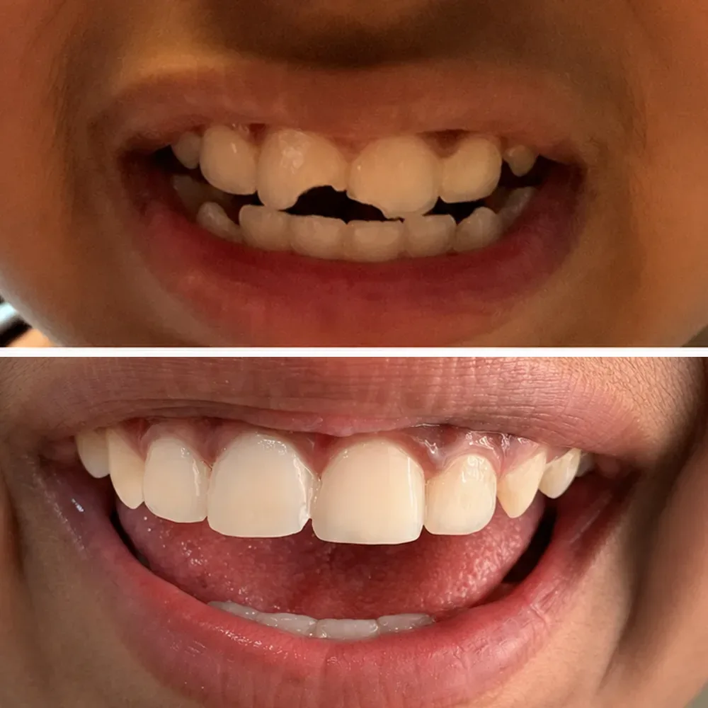 Case 08 before and after dental treatment