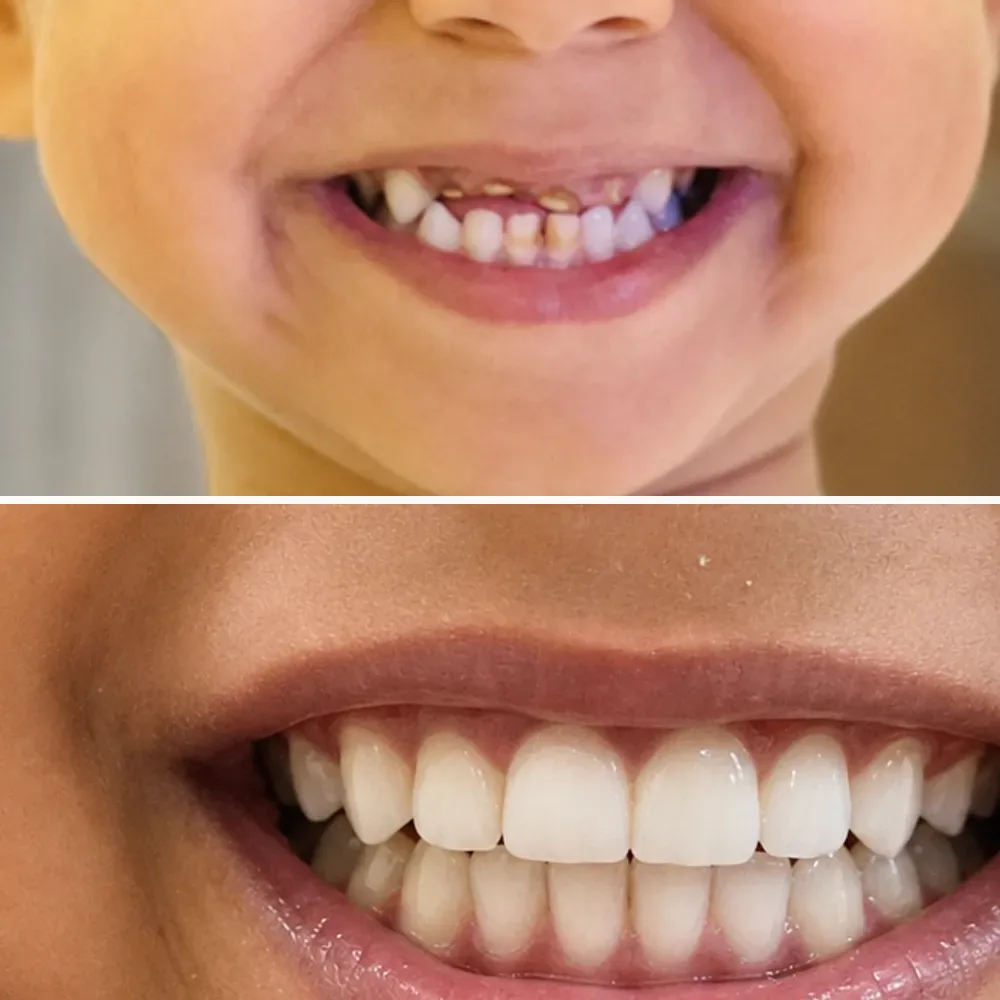 Case 09 before and after dental treatment