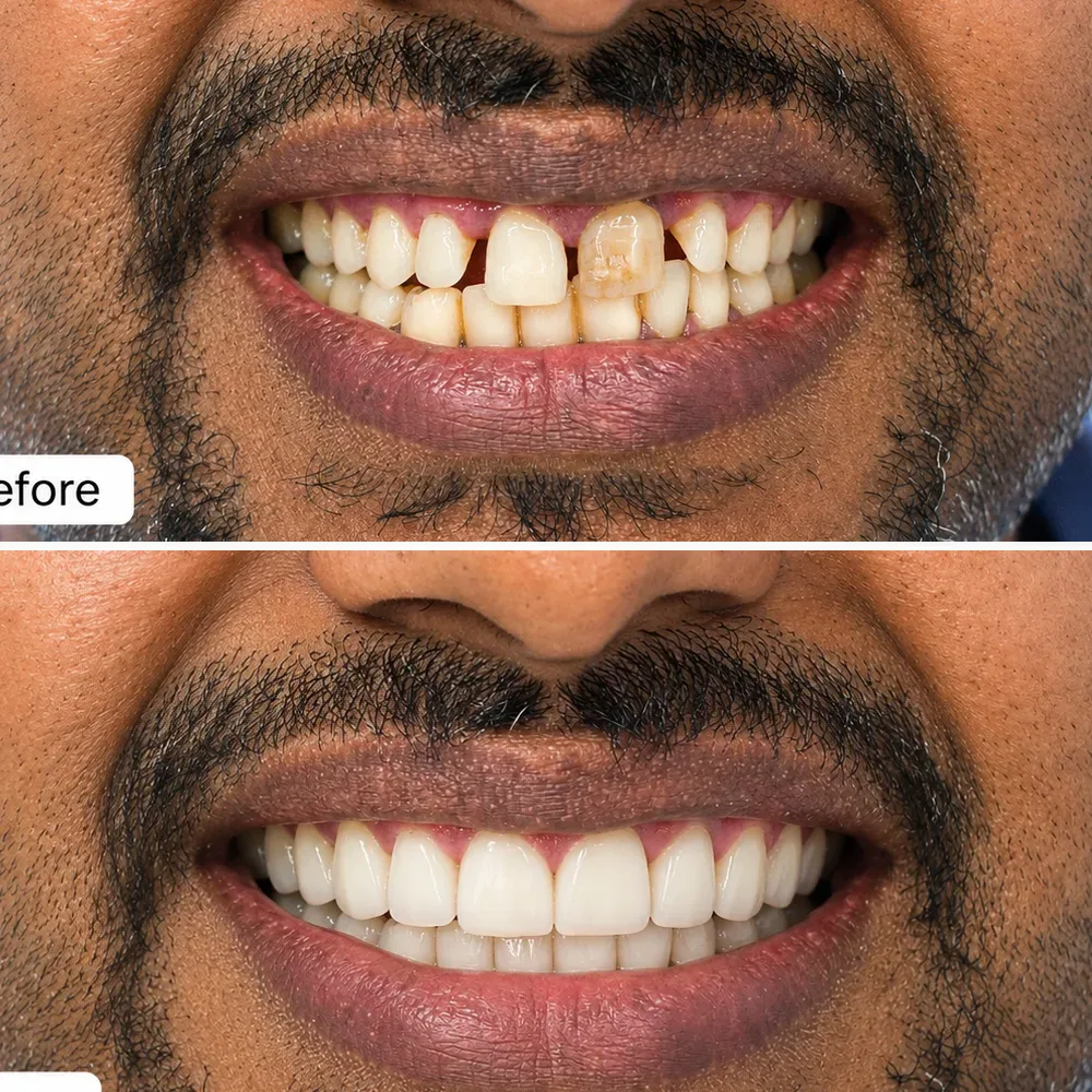 Case 10 before and after dental treatment